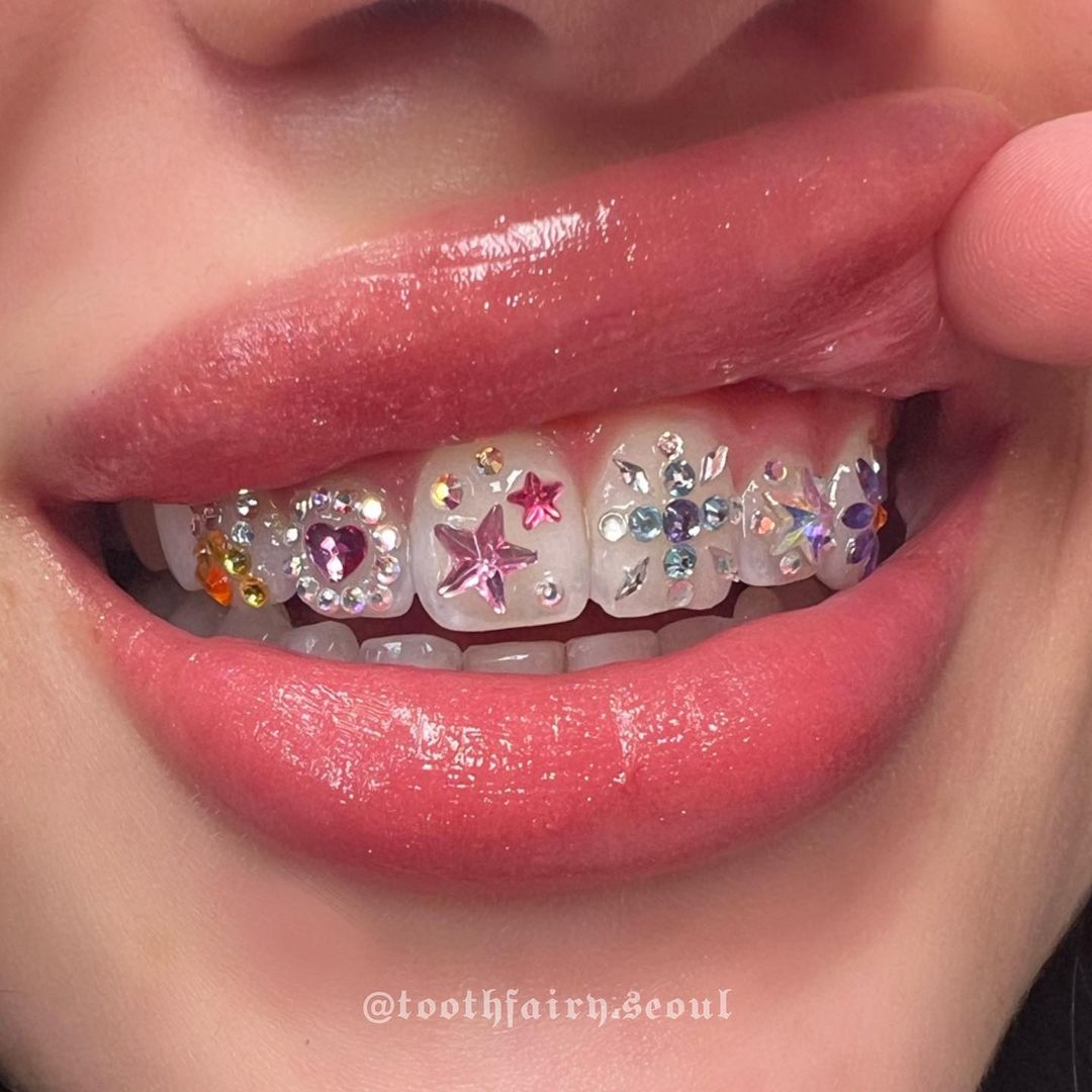 Tooth Gems