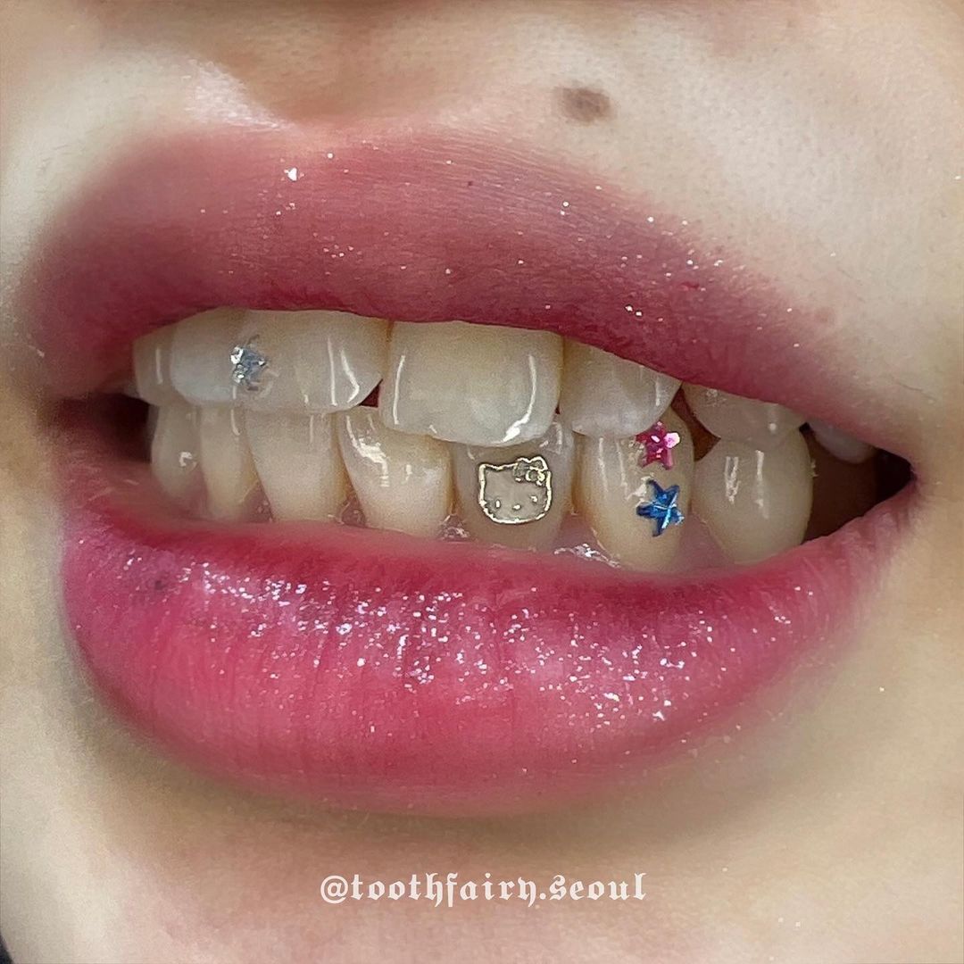Tooth Gems