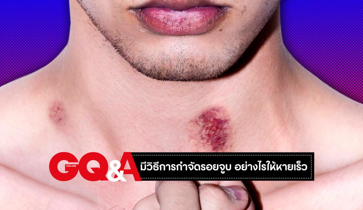 รูปที่3